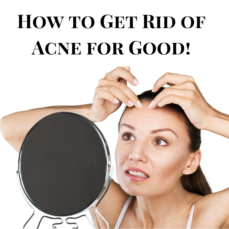 How to Get Rid of Acne Quickly & For Good: A Complete List of Tips & Hacks